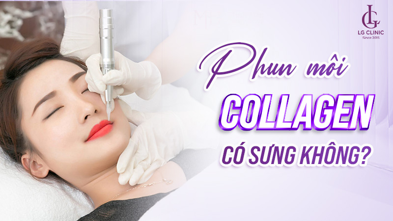 Phun môi collagen có sưng không?